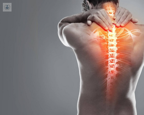 factores-de-riesgo-del-dolor-de-espalda imagen de artículo