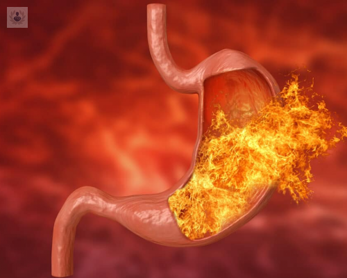 Gastritis: tratamiento y prevención