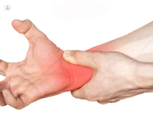 todo-lo-que-no-sabias-sobre-el-sindrome-del-tunel-del-carpo imagen de artículo