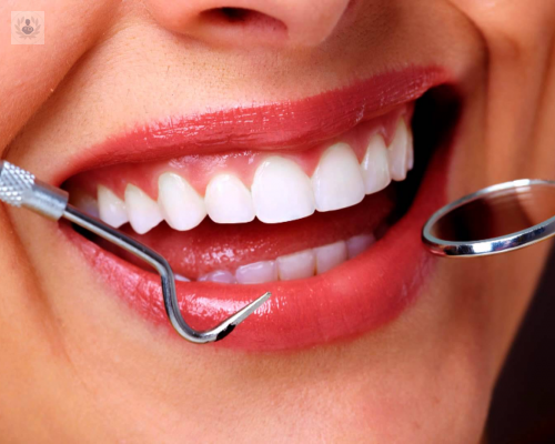 Mejora la apariencia de tus dientes