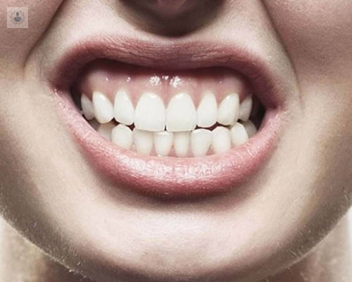 por-que-rechinan-los-dientes imagen de artículo