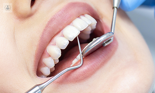 Aspectos generales de la Operatoria Dental