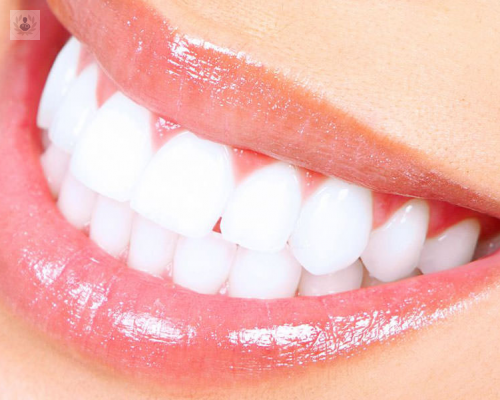 materiales-utilizados-en-diseno-de-sonrisa imagen de artículo