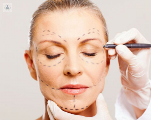Lifting Facial: una Cirugía para el Rejuvenecimiento