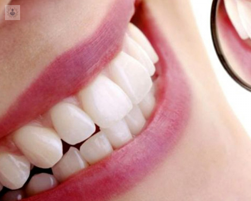 cambio-de-color-en-los-dientes imagen de artículo