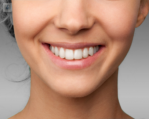 en-que-momento-puedo-realizarme-un-diseno-de-sonrisa imagen de artículo