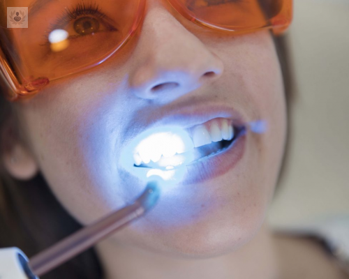 Blanqueamiento Dental: vitalidad para tus dientes