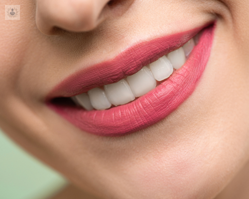 ¿Cómo funciona la Estética Dental?