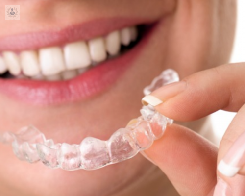 Invisalign: un tratamiento de Ortodoncia sin Brackets y 100% digital