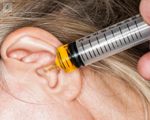 por-que-hacer-un-destaponamiento-de-oidos-a-tiempo imagen de artículo