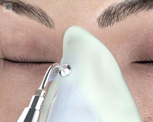 nuevas-tecnicas-para-la-rinoplastia imagen de artículo