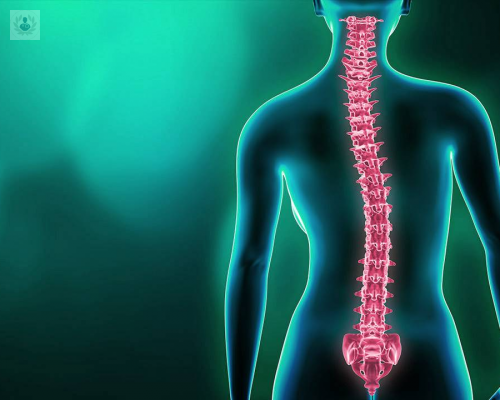 escoliosis-que-es imagen de artículo