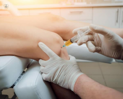 lo-que-debes-saber-sobre-las-infiltraciones-articulares imagen de artículo