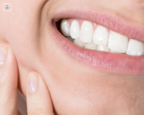 como-saber-si-tengo-bruxismo imagen de artículo