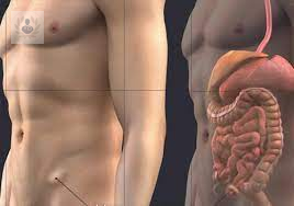 hernia-inguinal-diagnostico-y-tratamiento imagen de artículo