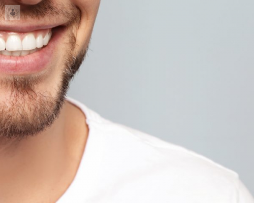 implantes-dentales-una-oportunidad-de-obtener-una-nueva-sonrisa imagen de artículo