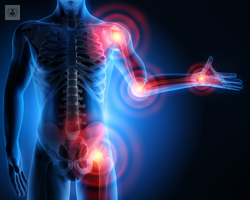 todo-lo-que-no-sabias-del-dolor-neuropatico imagen de artículo