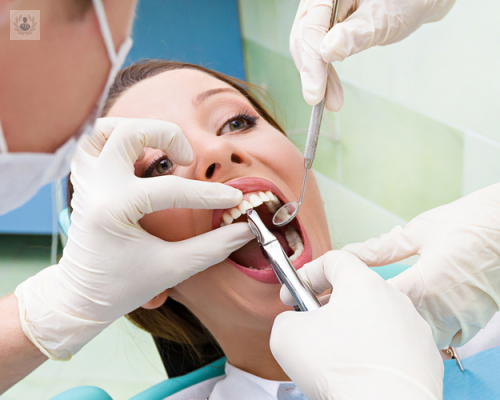 la-exodoncia-un-procedimiento-recomendable-para-la-salud-bucal imagen de artículo