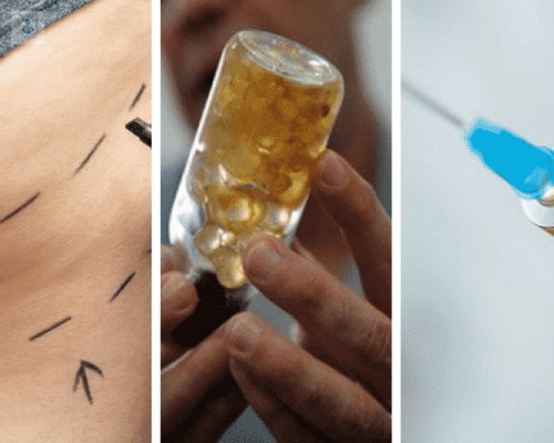 los-biopolimeros-como-rellenos-esteticos-pueden-ser-peligrosos imagen de artículo