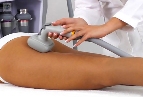 lipomax-el-laser-frio-que-reemplaza-a-la-liposuccion-tradicional imagen de artículo