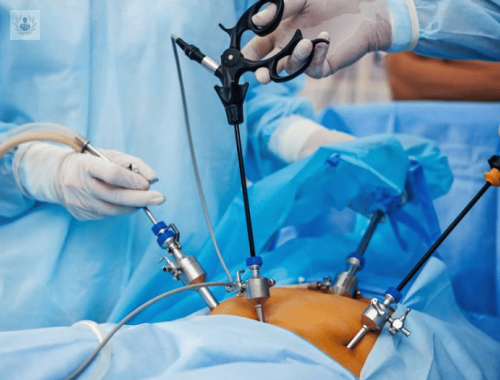 histeroscopia-procedimiento-clinico-de-gran-ayuda imagen de artículo