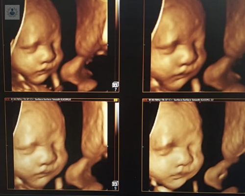 ecografia-a-detalle-el-examen-para-evaluar-el-bienestar-de-tu-bebe imagen de artículo