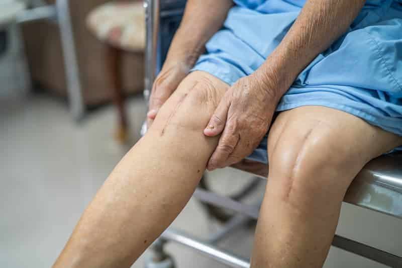 ¿Cuándo retornar a la actividad laboral después de un reemplazo total de cadera o rodilla?