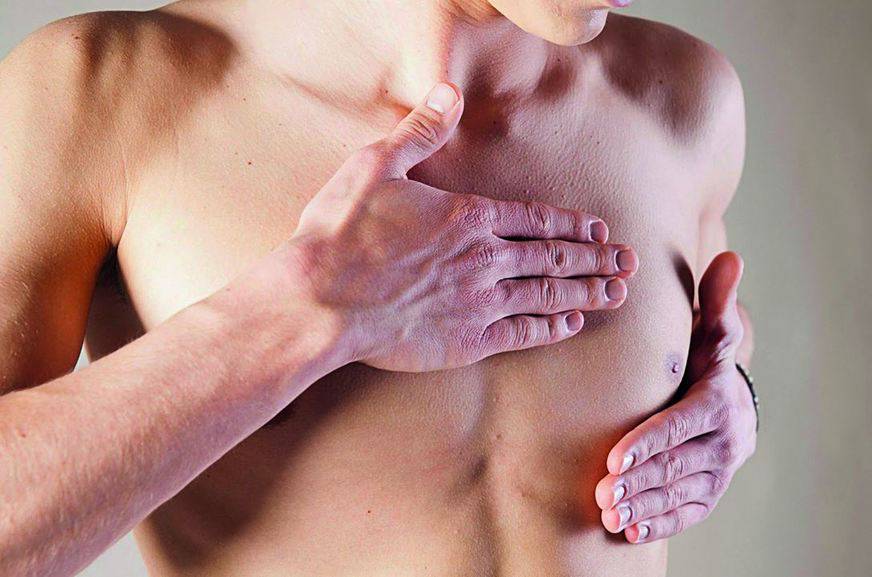 Ginecomastia: crecimiento anormal de la glándula mamaria en el hombre