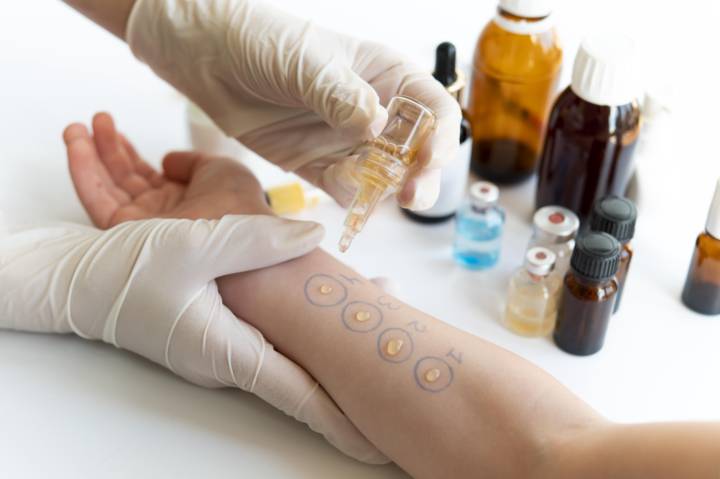 pruebas-de-alergia-metodos-y-consideraciones imagen de artículo