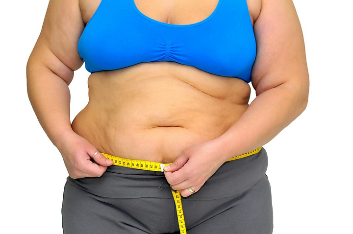 como-sera-mi-vida-despues-de-una-cirugia-para-la-obesidad imagen de artículo