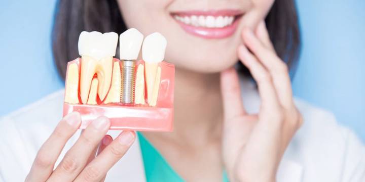 implantologia-una-oportunidad-de-revivir-tu-sonrisa imagen de artículo