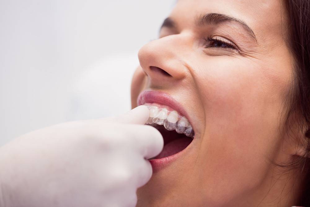 Dientes Desalineados: Impactos y Soluciones en Salud Bucal