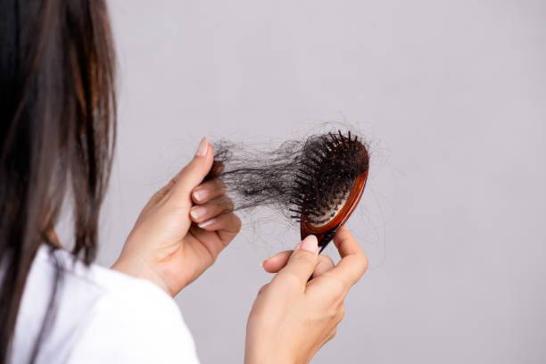 tratamiento-capilar-una-solucion-eficaz-para-la-perdida-prematura-del-cabello imagen de artículo