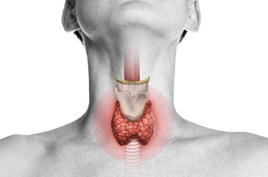 Hipotiroidismo: una disminución en la función de la glándula tiroidea