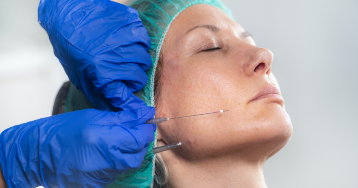 el-efecto-de-los-hilos-tensores imagen de artículo