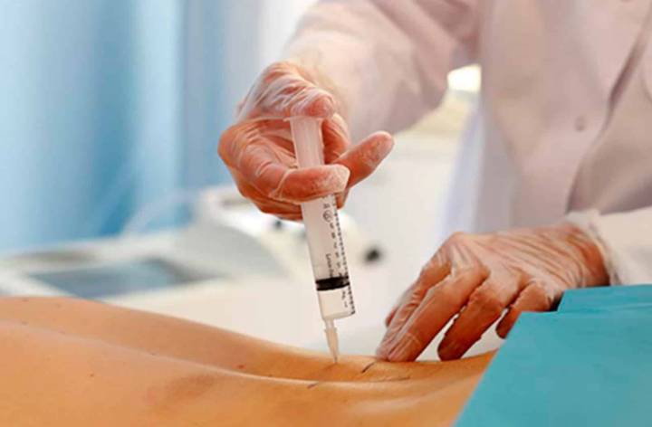la-ozonoterapia-como-alternativa-para-el-dolor-lumbar imagen de artículo