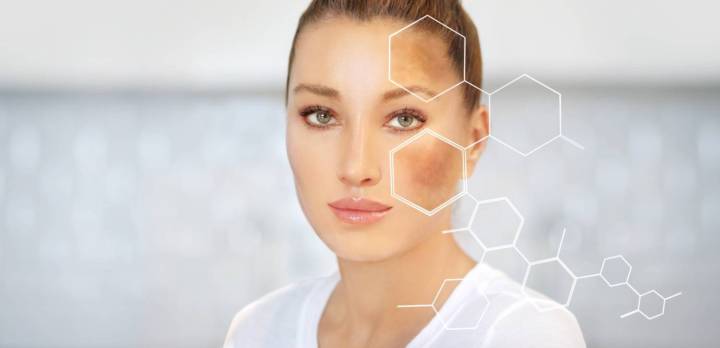 abordando-las-manchas-en-la-piel-melasma-y-otras-causas imagen de artículo