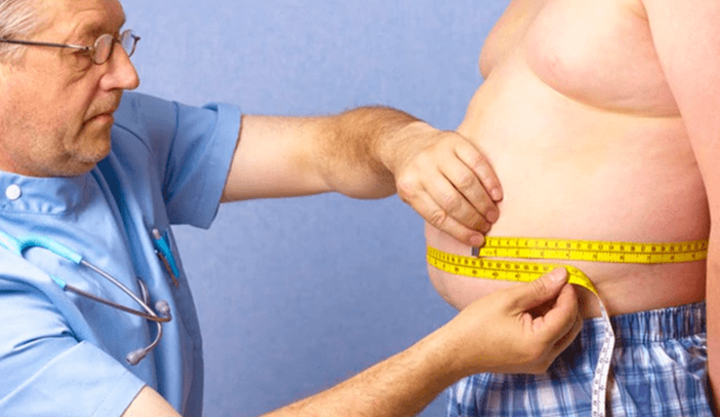 Cirugía de la Obesidad ¿Cómo se realiza?