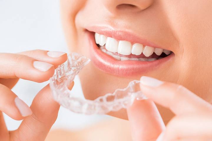 transparencia-y-eficiencia-avances-tecnologicos-en-la-ortodoncia-invisible imagen de artículo