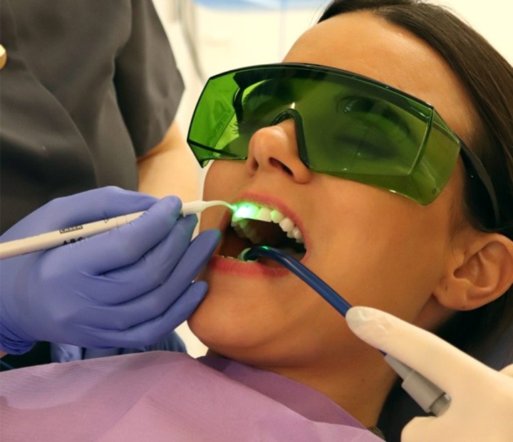 el-impacto-del-laser-en-la-endodoncia imagen de artículo