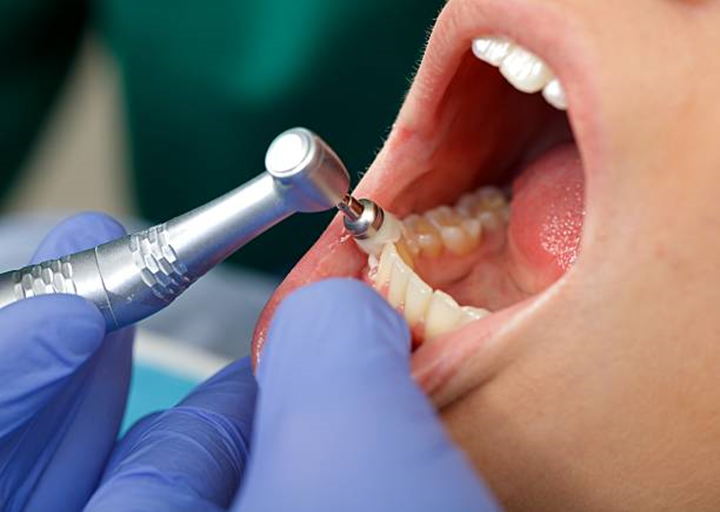 La importancia de la limpieza dental, visita al Odontólogo