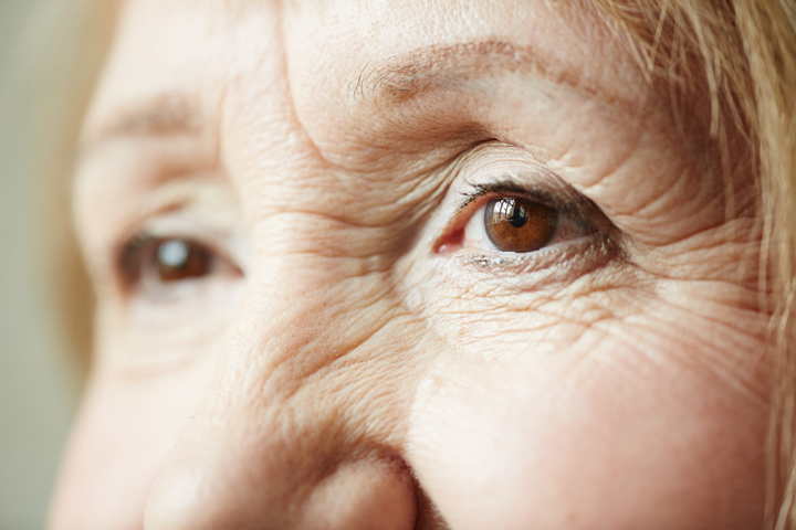 Glaucoma y Cataratas: información vital para una visión saludable