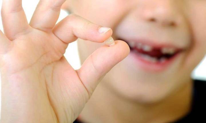 caida-de-dientes-como-prevenir-y-manejar-este-problema imagen de artículo