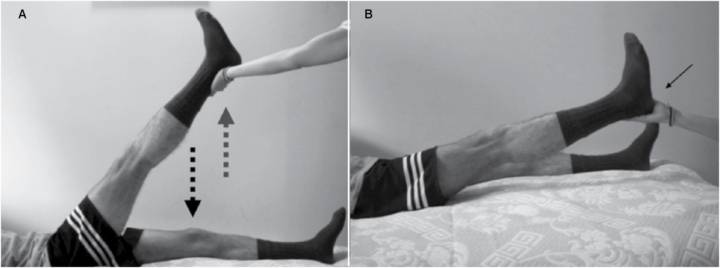 descubrimiento-del-signo-de-acevedo-avance-crucial-en-el-diagnostico-del-dolor-de-espalda imagen de artículo