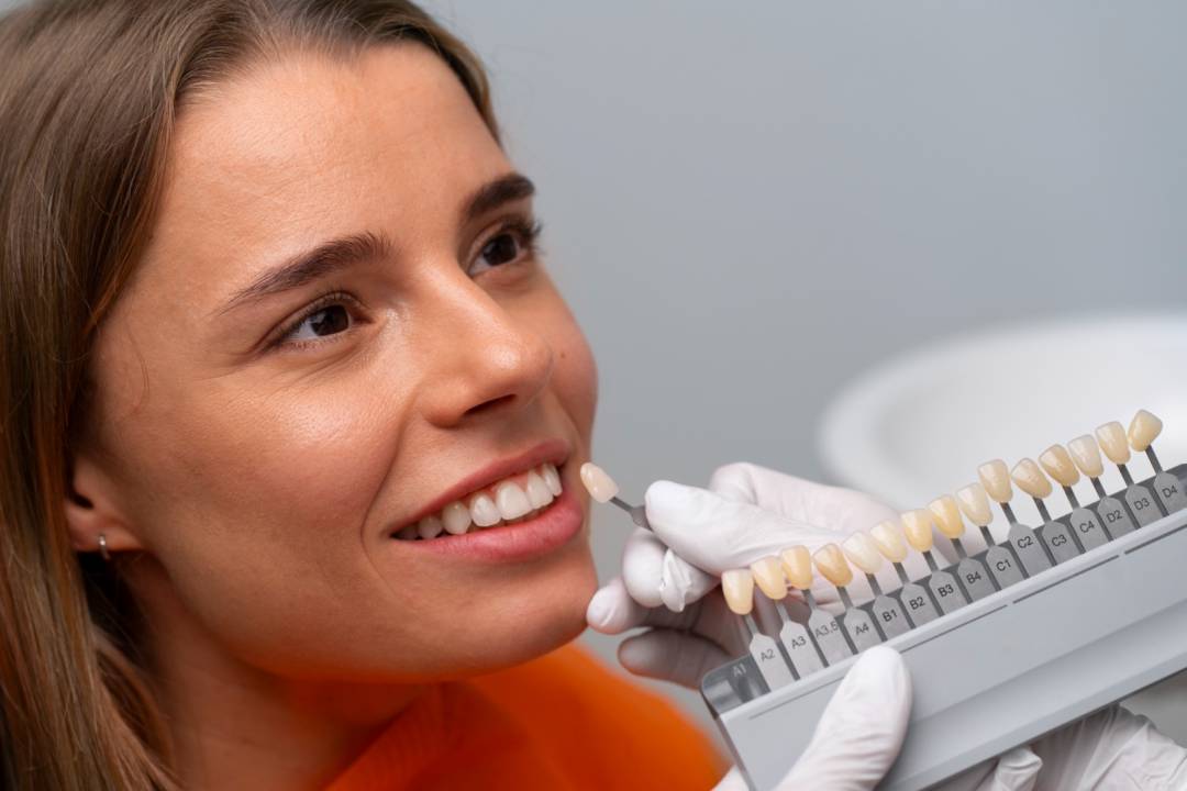 Beneficios de los Implantes Dentales: Una solución para su salud bucal