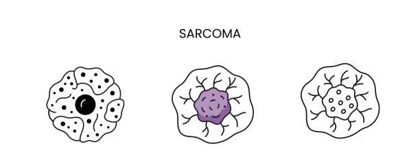 sarcomas-una-perspectiva-desde-la-cirugia-oncologica imagen de artículo