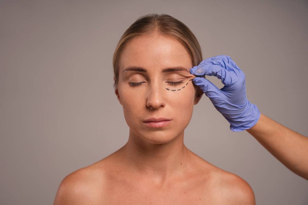 blefaroplastia-rejuvenece-mirada-recupera-vitalidad-ojos imagen de artículo