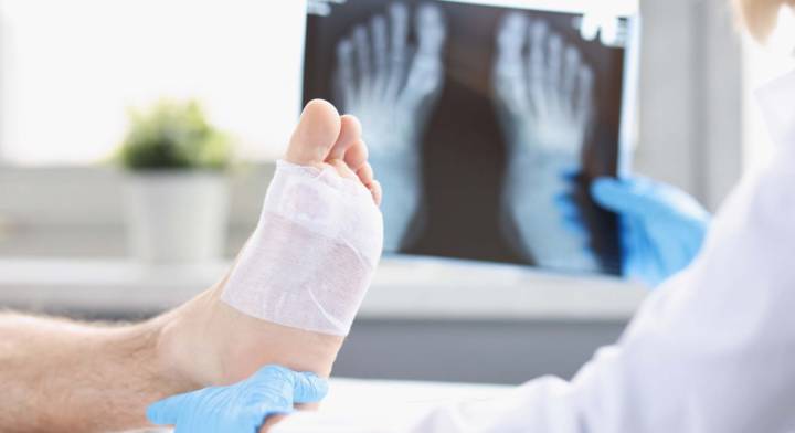 que-hacer-ante-una-fractura-guia-medica-para-su-atencion-y-recuperacion imagen de artículo
