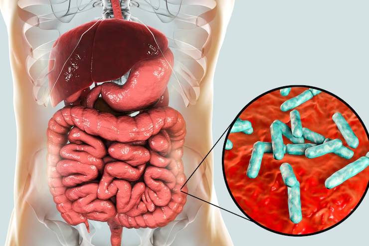 infeccion-helicobacter-pylori-que-es-sintomas-tratamiento imagen de artículo