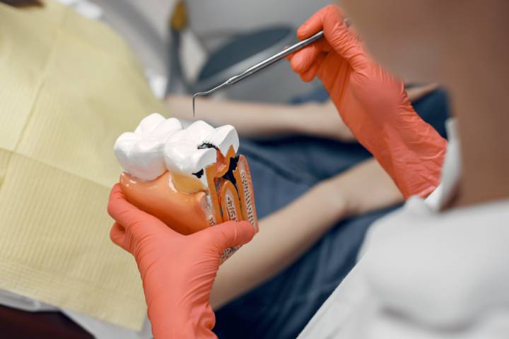 endodoncia-salva-tu-diente-y-alivia-el-dolor imagen de artículo
